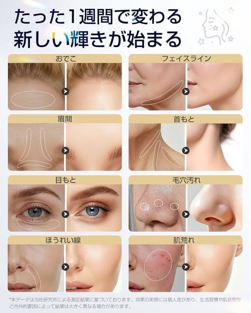 RF EMS 美顔器 1台18役おうちエステ 高周波 MC 毛穴 エイジング
