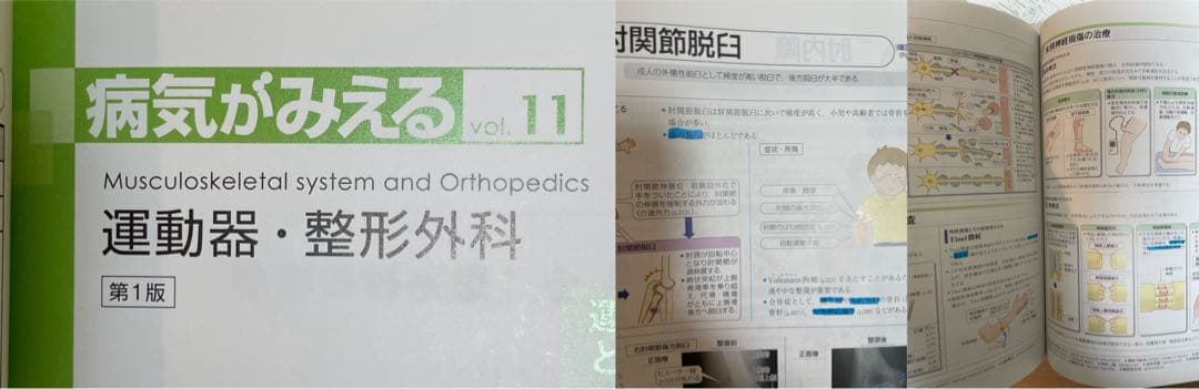 【12冊セット】病気がみえるvol1-11＋公衆衛生がみえる