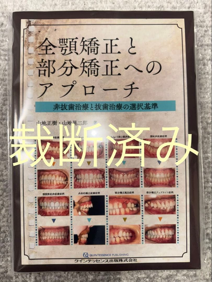 【裁断済み】全顎矯正と部分矯正へのアプローチ　非抜歯治療と抜歯治療の選択基準