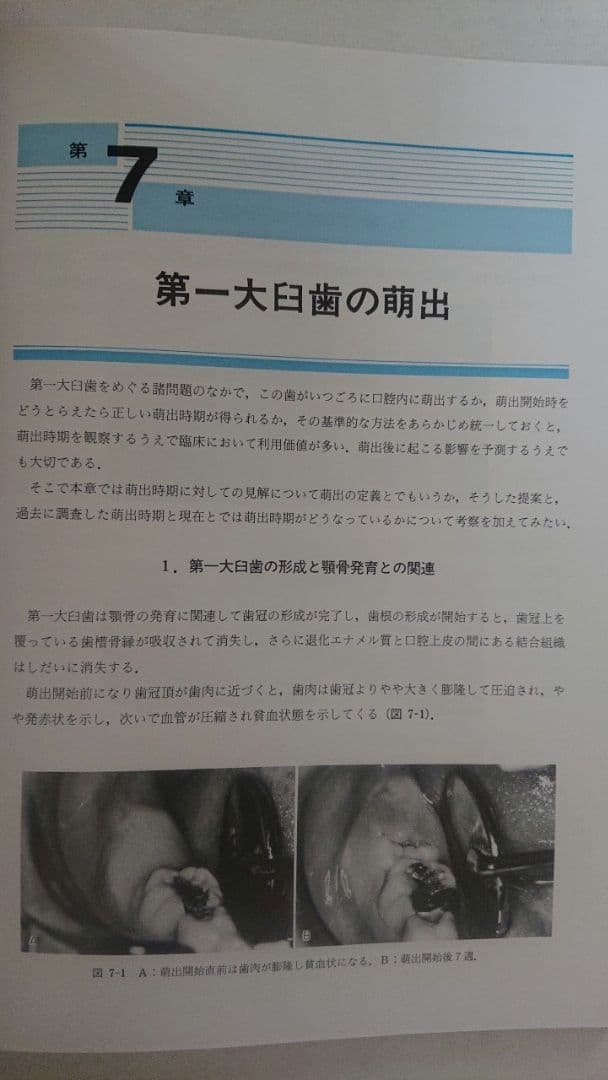 第一大臼歯